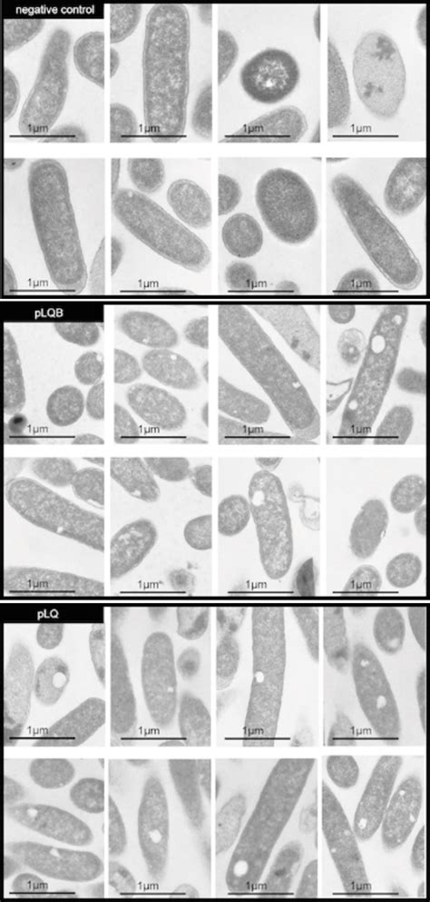 Team:Kyoto/Project/Magnetosome Formation - 2014.igem.org