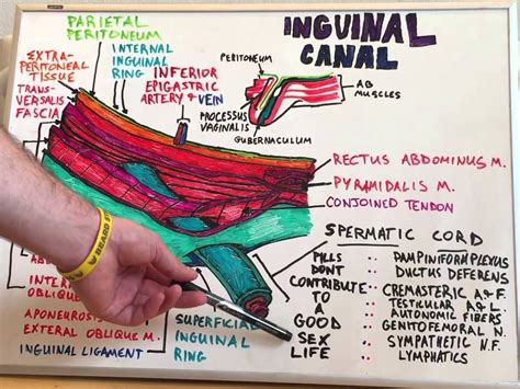 Pin by Bilhan Chavez on Escolar | Anatomy, Hernia inguinal, Body anatomy