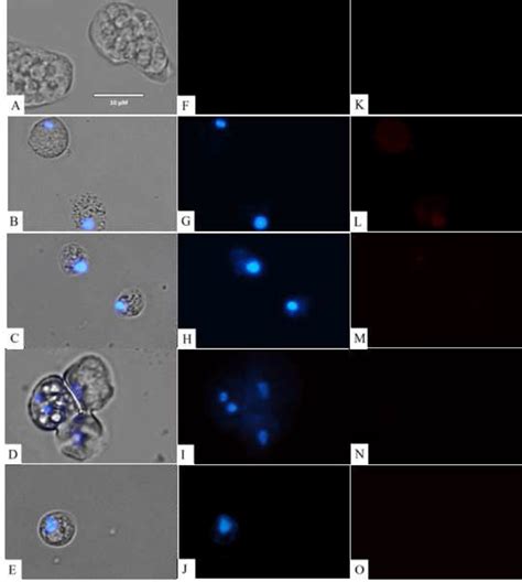 Higher magnification of Fig. 1. Images (x100) showing apoptotic cells... | Download Scientific ...