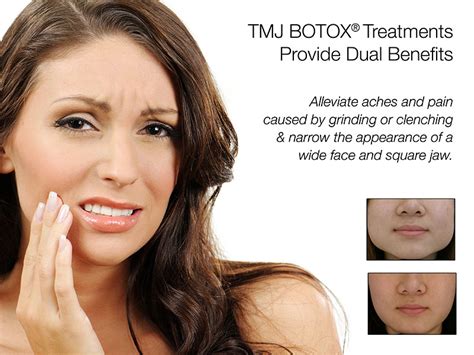 Therapeutic/Aesthetic Botox / Dermal Fillers - Lyford Smiles