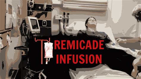 Remicade Infusion for Crohn's Disease - YouTube