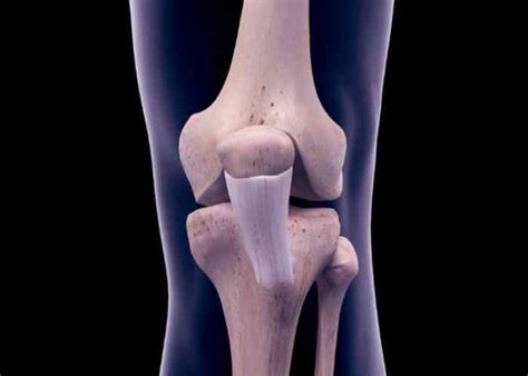 Medial Patellofemoral Ligament Injury | MPFL Specialist | Sugar Land, Pearland, Houston, TX