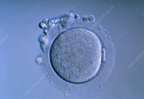 Human Egg Cell Under Microscope