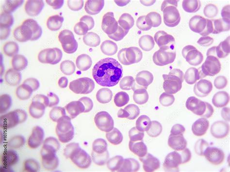 Fotografia do Stock: Neutrophil cell (white blood cell) in peripheral ...