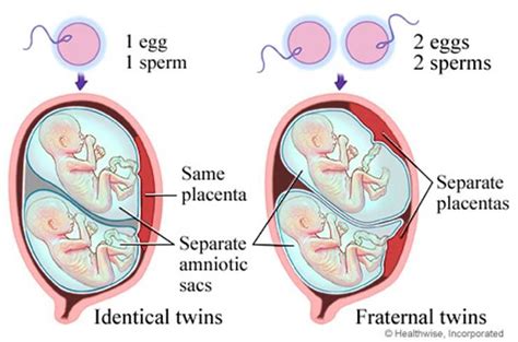 Pin on twin pregnancy