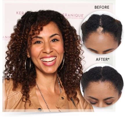 Keranique Reviews | Does Keranique Work To Regrow Hair