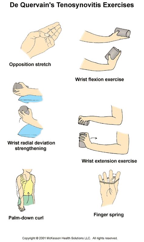 Sports Medicine Advisor 2003.1: De Quervain's Tenosynovitis Exercises ...