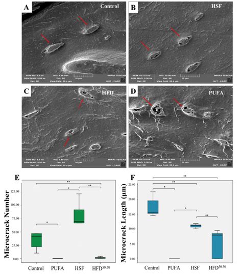 (A-D) Scanning electron micrographs showing osteocytes within their... | Download Scientific Diagram