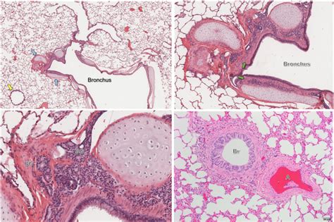 Bronchi and Bronchioles Histology Diagram | Quizlet