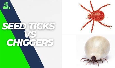 Seed Ticks Vs Chiggers - In 5 Important Points Explained! | Y-L-P-C