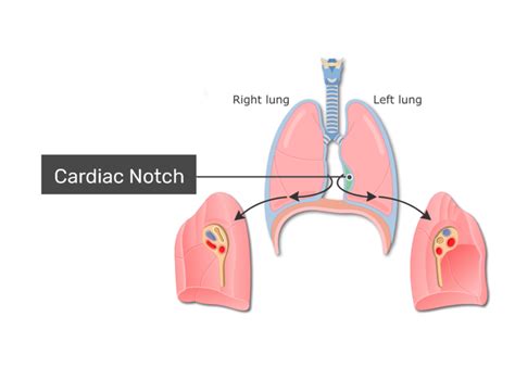 Cardiac Notch Anatomy