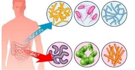 Symptoms of gut flora imbalance