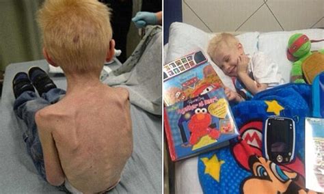 Five-year-old starved in closet Jordan Bleimeyer pictured on road to recovery | Daily Mail Online