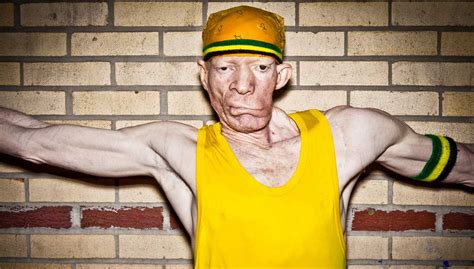 Yellowman Bio | ORSVP | Dancehall music, Jamaican music, Reggae artists