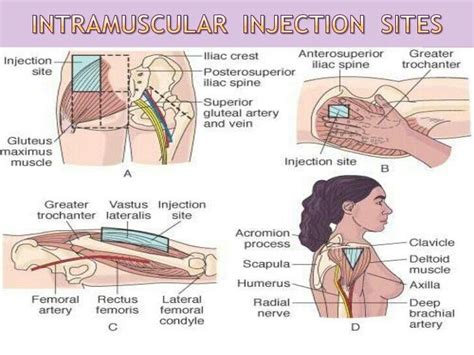 Intravenous Injection Sites