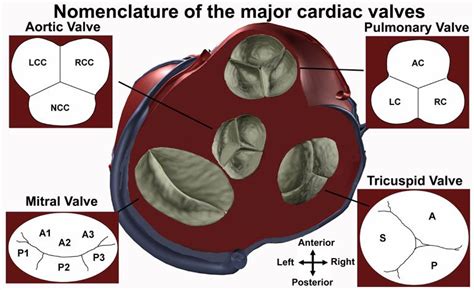 Aortic Valve Cusps On Echo | University of Minnesota | I want to be Dr ...