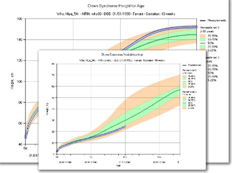 Cdc Down Syndrome Growth Chart - Captions Ideas