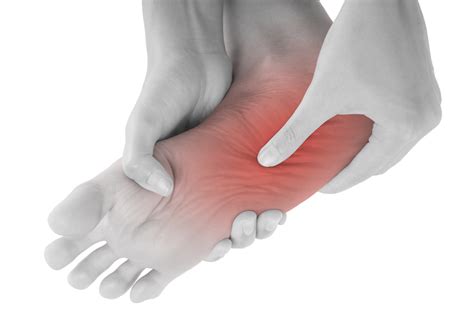 Arch Pain Treatment – My FootDr