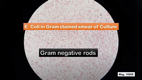 GRAM POSITIVE VS GRAM NEGATIVE BACTERIA | escherichia coli gram stain – Webgiasi.vn – Siêu thị ...