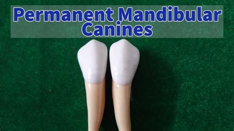 Permanent Mandibular Canine - YouTube