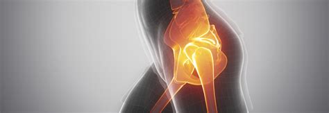 Damaged Hip Cartilage Replaced with First-of-its-Kind Procedure | Duke Health Referring Physicians