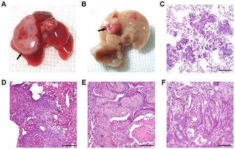 DEN-induced tumors in BMT mice. (A) Gross pathology of a representative ...