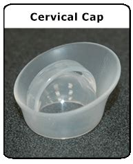 Birth Control: Cervical Caps | Rady Children's Hospital