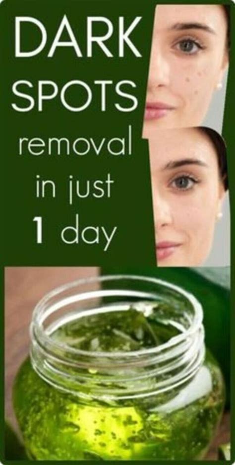 I Got Shocked With The Results Of This Magical Remedy, It Removed Dark ...