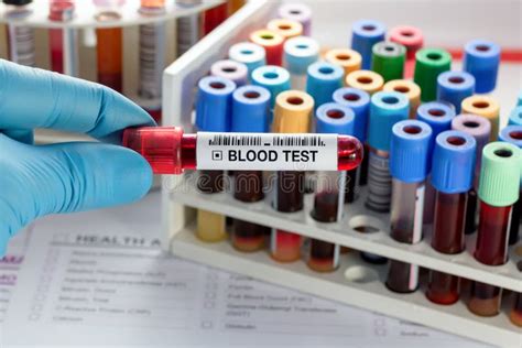 Technician Holding Blood Sample Tube for Analysis in the Hematology Lab ...