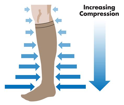 Compression Socks for Varicose Veins - Vein Specialists of the South