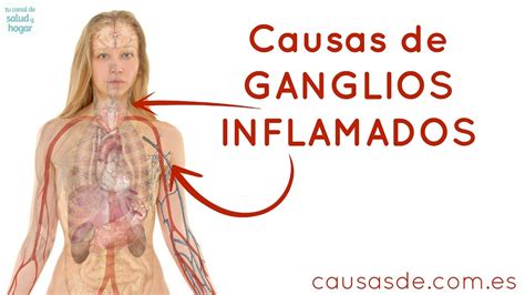 ️ ¡Inflamación De Ganglios Axilares: ¿Por Qué? ⚡ InfoAxilas