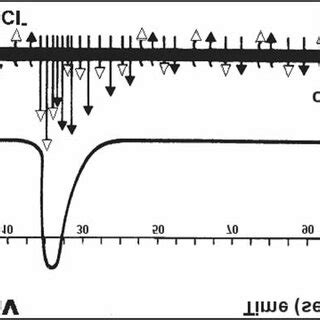 Change of membrane potential during depolarization and repolarization ...