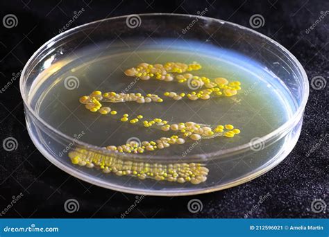 A Petri Dish with Common Yeast and Bacteria Colonies Stock Image ...