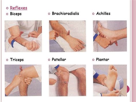 Biceps, Triceps, and Brachioradialis Reflex