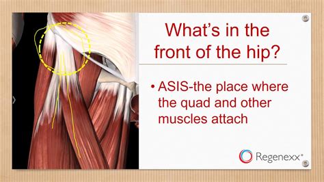 Stem Cell Blog | 5 Possible Causes for Pain at the Front of the Hip