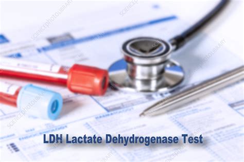 Lactate dehydrogenase test, conceptual image - Stock Image - F037/1176 - Science Photo Library