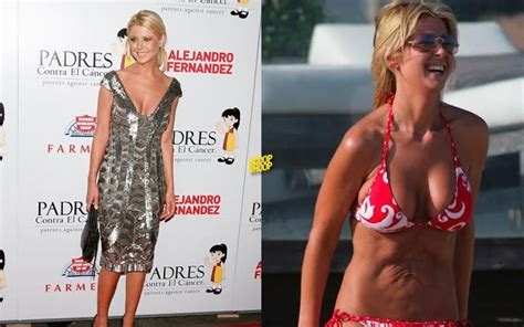 17 Celebrities Who Looked Better When They Weren’t ‘Skinny’ - ScoopWhoop