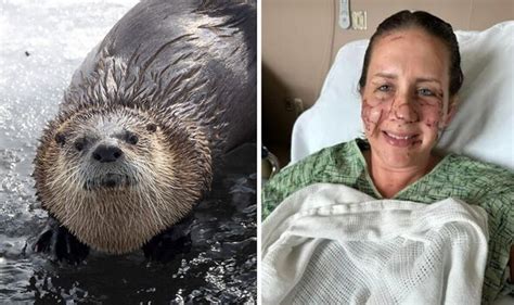 Woman in desperate battle for survival after 'vicious' otter attack | US | News | Express.co.uk