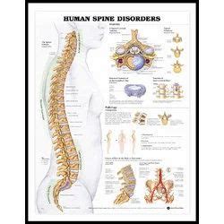 Human Spine Disorders Chart at best price in Pune by Bep Edu World | ID ...