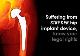 Stryker Hip Replacement Lawyer Site - Blog