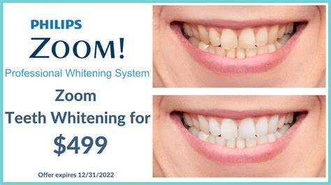 Zoom Teeth Whitening – Arlington MA Dentist – Arlington Dental 43 Broadway, Arlington, MA 02474 ...