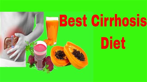 Best DIET FOR CIRRHOSIS of the Liver - YouTube