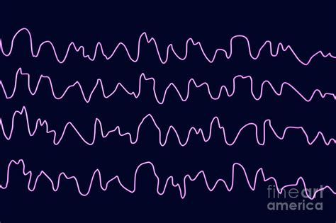 Brain Waves During Sleep Photograph by Kateryna Kon/science Photo ...