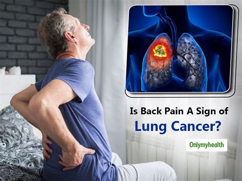 What Is The Correlation Between Back Pain and Lung Cancer? | OnlyMyHealth