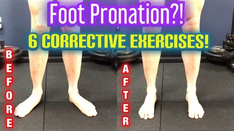 Overpronation Exercises