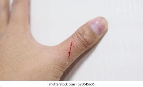 3,152 Cat scratch skin Images, Stock Photos & Vectors | Shutterstock