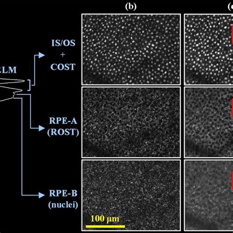 RPE cell density and cone-to-RPE ratio are shown as a function of... | Download Scientific Diagram