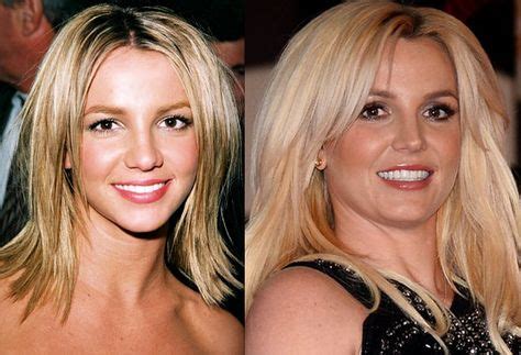 Britney Spears Before & After Plastic Surgery Photos. | Celebrity Nose Jobs | Britney spears ...