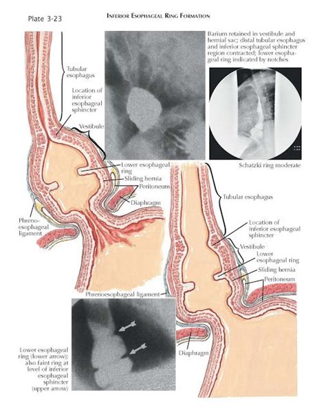 an image of medical diagrams showing the different areas of the neck ...