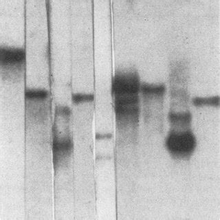 Southern analysis of EcoRI-digested H. influenzae DNA, using an... | Download Scientific Diagram